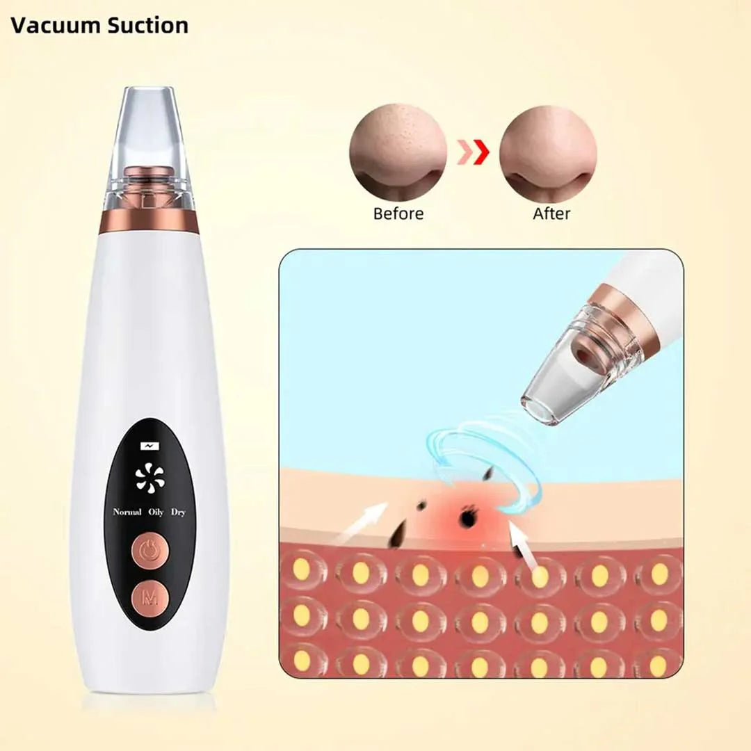 Derma Suction blackhead remover