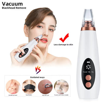 Derma Suction blackhead remover